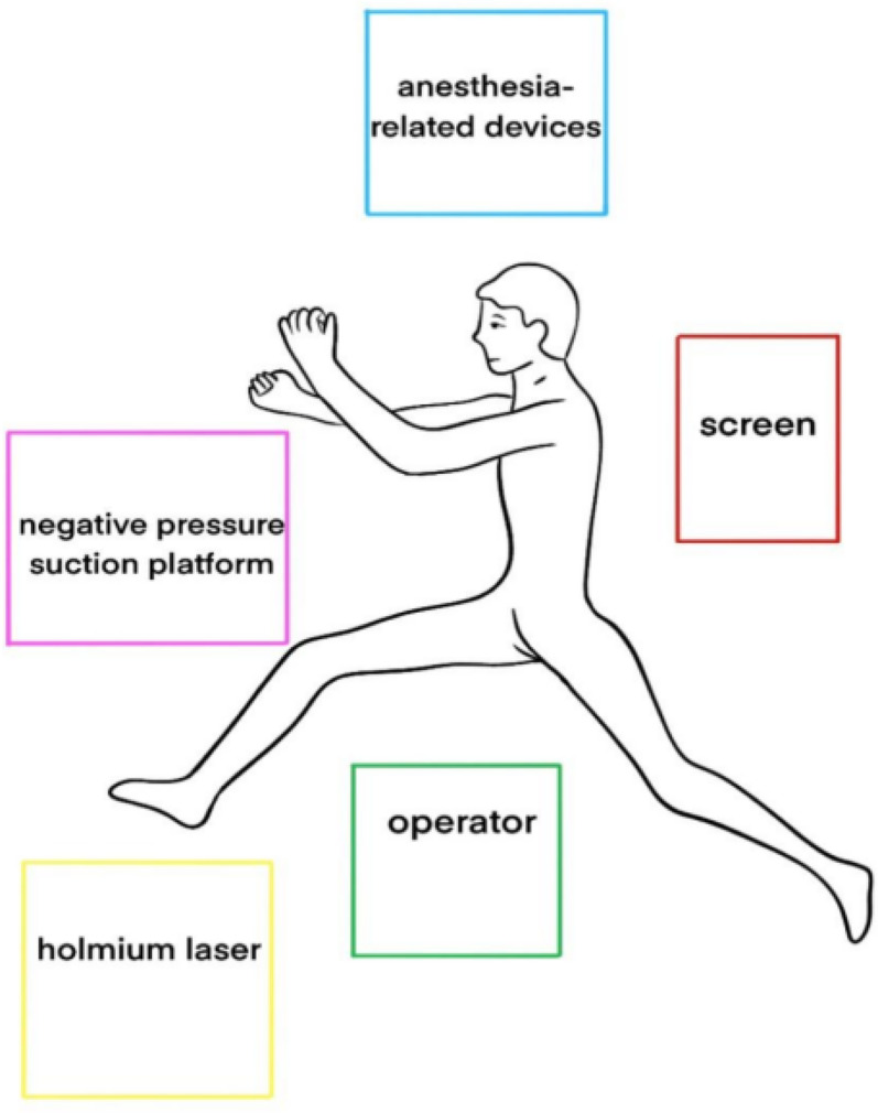 A comparative study of flexible and navigable suction ureteral access sheath combined with single-use flexible ureteroscopes and percutaneous nephrolithotomy in the treatment of kidney stones > 2.5 cm: a single-center retrospective study.