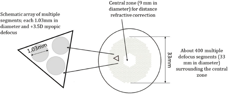 Efficacy of Spectacle Correction Using Defocus Incorporated Multiple Segments in the Myopic Population.