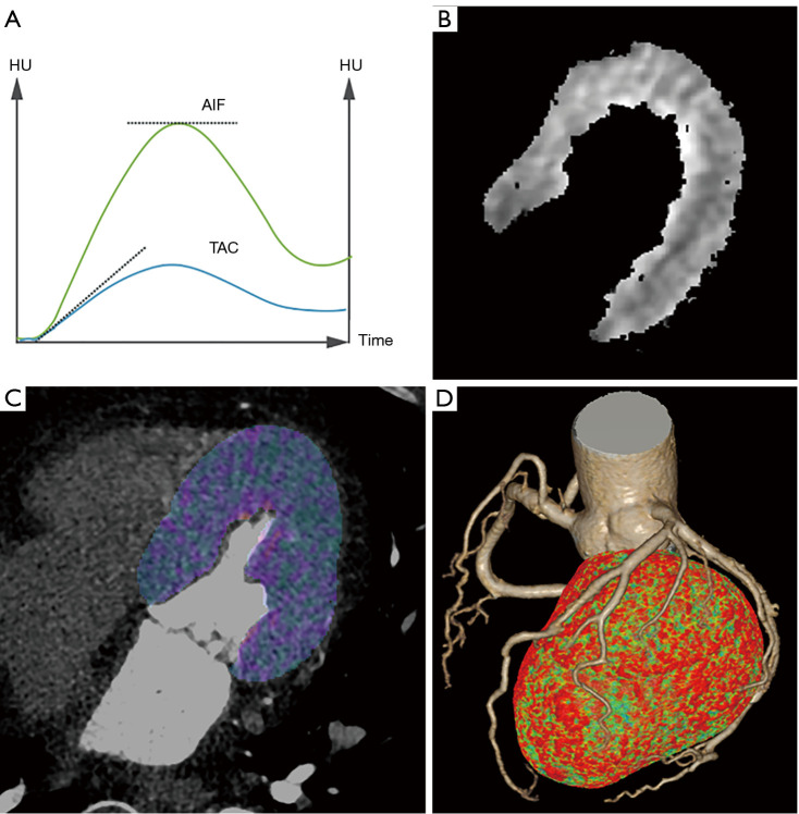 Fractional flow reserve calculation optimized by myocardial computed tomography perfusion information.