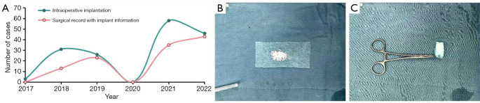 Enhancing postoperative recurrence assessment in gastric and colorectal cancer patients with intraperitoneal fluorouracil implants: overcoming the diagnostic challenge of fluorouracil implant-related tumor-like lesions.