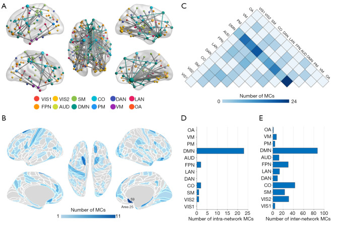 Disruptions of morphological brain networks and their associations with multi-symptoms in children with spastic cerebral palsy.