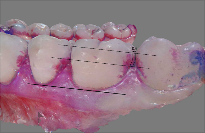 Does proper flossing performance translate into effective plaque removal?