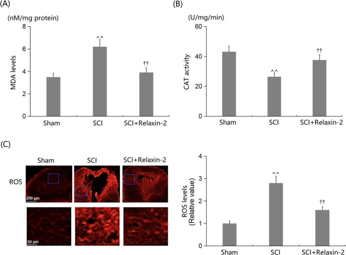 Relaxin-2 Ameliorates Spinal Cord Injury by Inhibiting Microglia Activation.