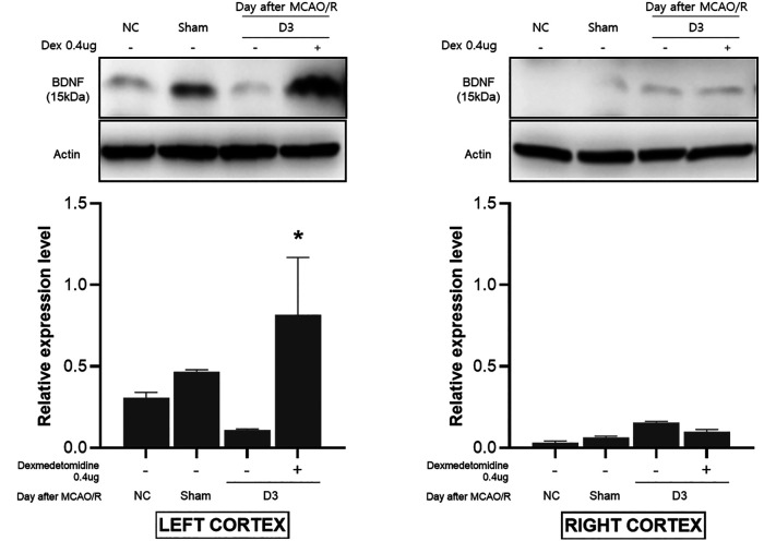 Dexmedetomidine Up-regulates Brain-derived Neurotrophic Factor <i>via</i> Nrf2 in a Mouse Middle Cerebral Artery Occlusion Model.