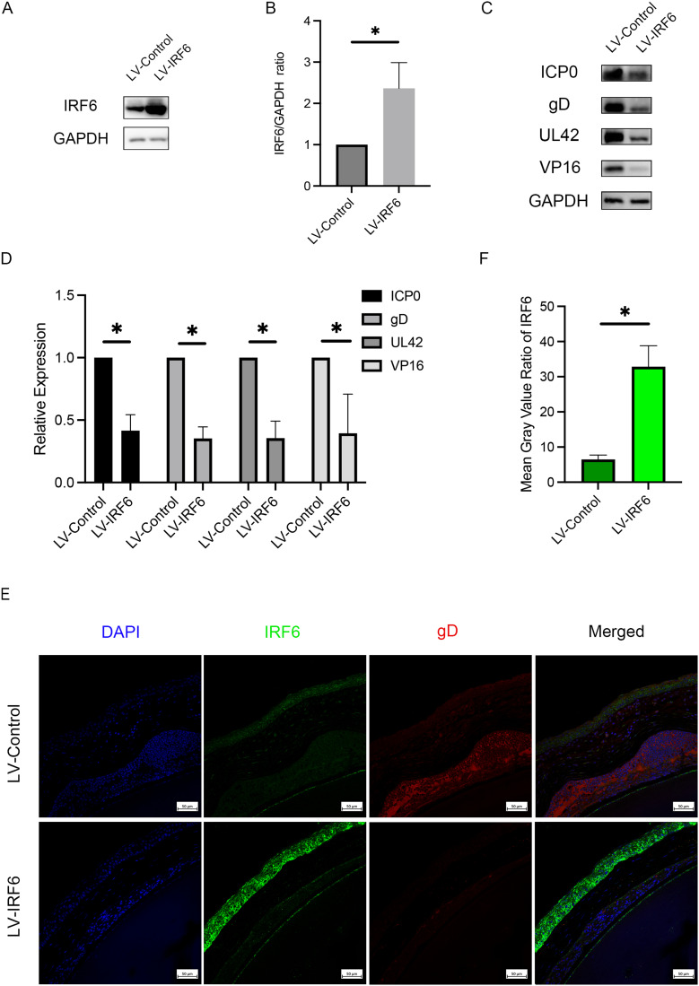 IRF6 Enhances IFN-β Expression and Inhibits Viral Replication to Reduce the Severity of Herpetic Stromal Keratitis.