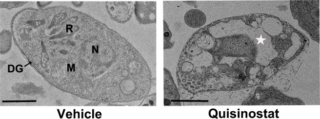 <i>In vitro</i> and <i>in vivo</i> activity of quisinostat against <i>Toxoplasma gondii</i>.