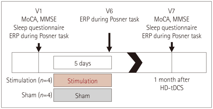 Effect of Parietal High-Definition Transcranial Direct Current Stimulation on Cognitive Function in REM Sleep Behavior Disorder With Mild Cognitive Impairment: A Sham-Controlled Pilot Study.
