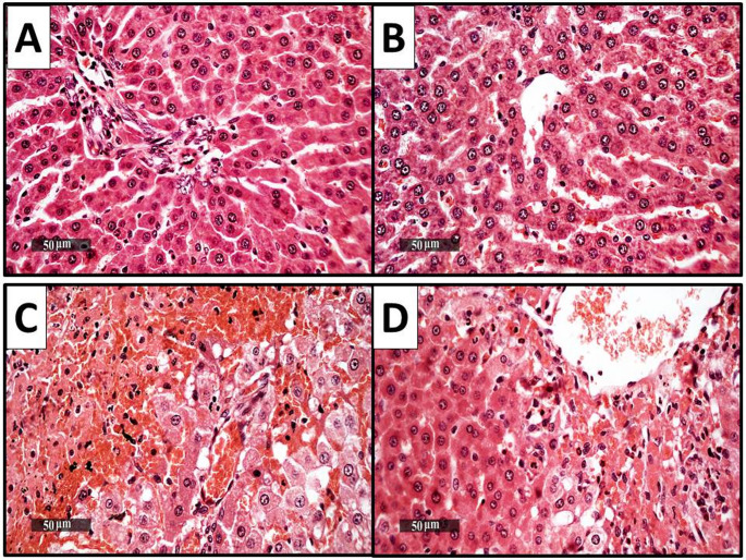 TLR-4/Notch1/NF-κB pathway modulation by dapagliflozin: a novel mechanism for neuroprotection in hepatic encephalopathy.