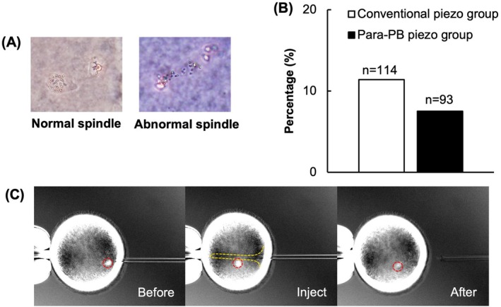Sperm Injection at the Para-Polar Body Site in Piezo-Intracytoplasmic Sperm Injection Improves Subsequent Early Development of Bovine Embryos.