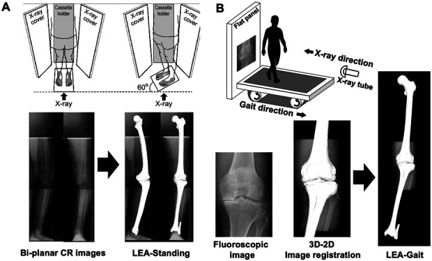 Three-Dimensional Lower Extremity Alignment During the Stance Phase of Gait Using Anteroposterior Fluoroscopic Imaging and Image-Matching Technique: A Comparison with the Standing Position in Advanced Knee Osteoarthritis.