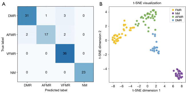 Classification of mitral regurgitation in echocardiography based on deep learning methods.