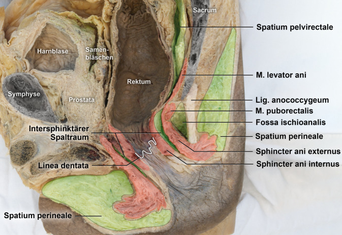 [Anal fistula disease : Anatomical foundations and surgical procedures].