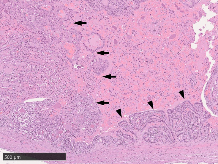 Primary seminal vesicle adenocarcinoma in a squirrel monkey (Saimiri sciureus).