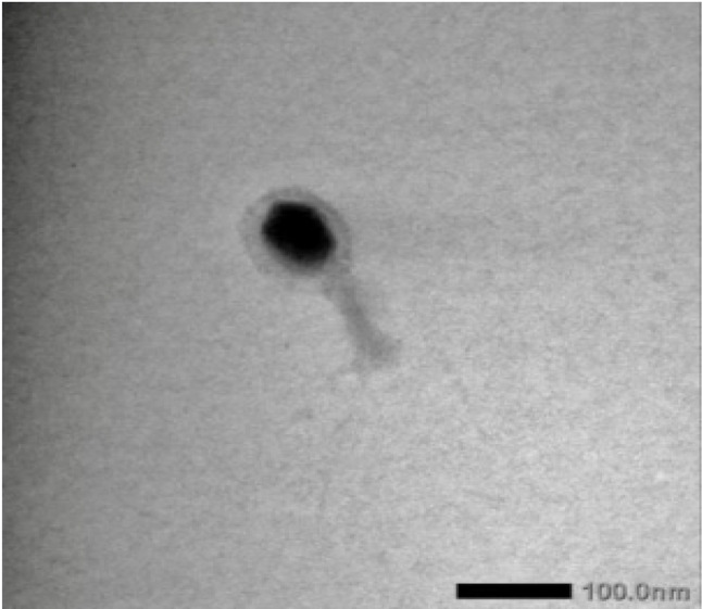 Isolation and molecular characterization of bacteriophages isolated from lake water and their application in foods against Bacillus cereus.