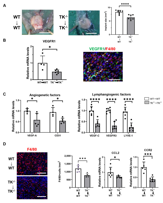 Inhibition of VEGFR1 TK Signaling in Peritoneal Macrophages Suppresses Endometriosis Development.