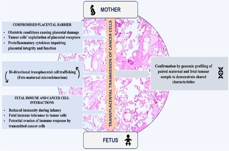 Transplacental cancer transmission: a comprehensive review focusing on mechanisms, challenges, and maternal-fetal outcomes.