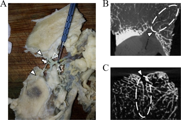 A New Nanotechnology for Imaging the Juxta-Articular Intraosseous Vasculature-Canal Complex and Related Clinical Pilot Studies.