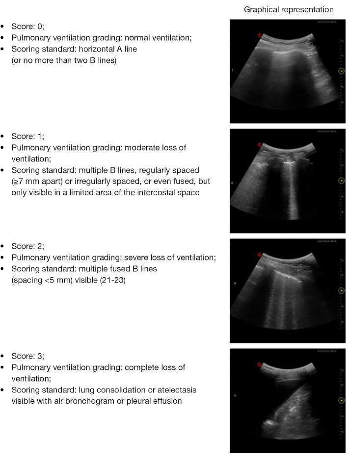 Prediction of weaning outcomes from mechanical ventilation in critically ill patients based on the combination of ultrasound parameters of the heart, lung, and diaphragm: a prospective observational cohort study.