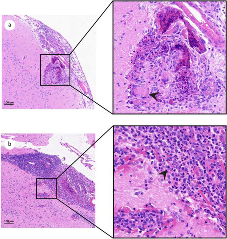 Same parasite, diverging fates: distinct responses of tenrecs to Angiostrongylus cantonensis infection.