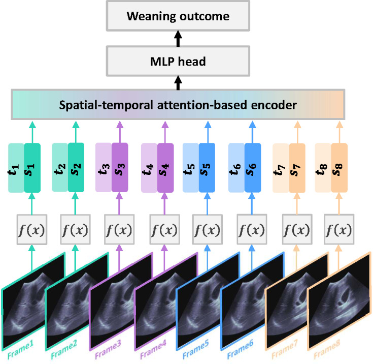AI Model Based on Diaphragm Ultrasound to Improve the Predictive Performance of Invasive Mechanical Ventilation Weaning: Prospective Cohort Study.