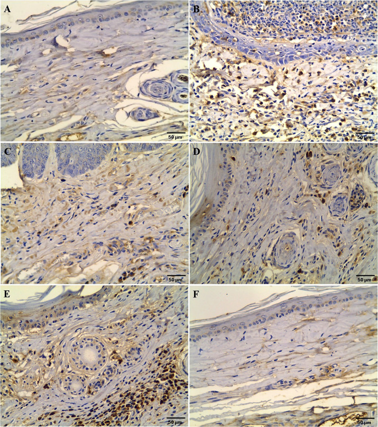 Restorative potential of melatonin during treatment of severe scabies in an experimental model.