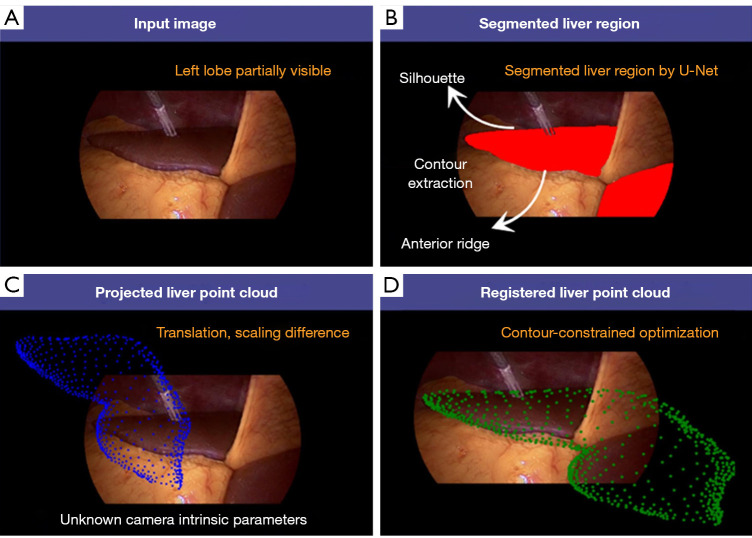Non-rigid image-volume registration for human livers in laparoscopic surgery.