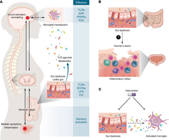 Microbiota in interstitial cystitis/bladder pain syndrome: evidence and opportunities.