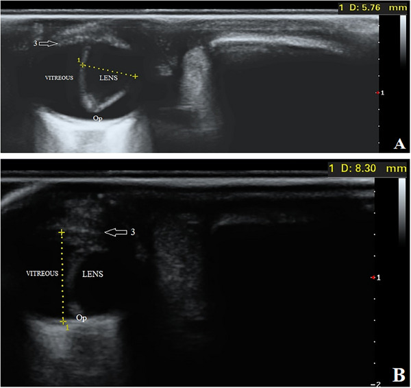 Complex Microphthalmia in Three Central Asian Shepherd Dogs.
