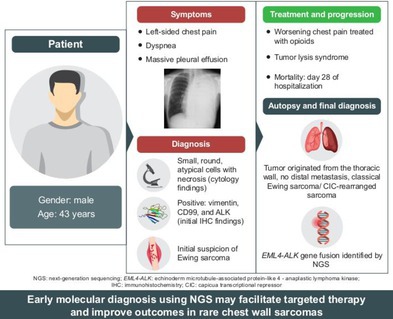 Anaplastic Lymphoma Kinase-Rearranged Chest Wall-Undifferentiated Small Round Cell Sarcoma With Massive Pleural Effusion and Rapid Progression: A Case With Autopsy Report.