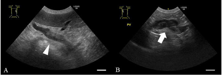 Treatment of portal vein thrombosis with rivaroxaban in an American cocker spaniel with chronic hepatitis: a case report.