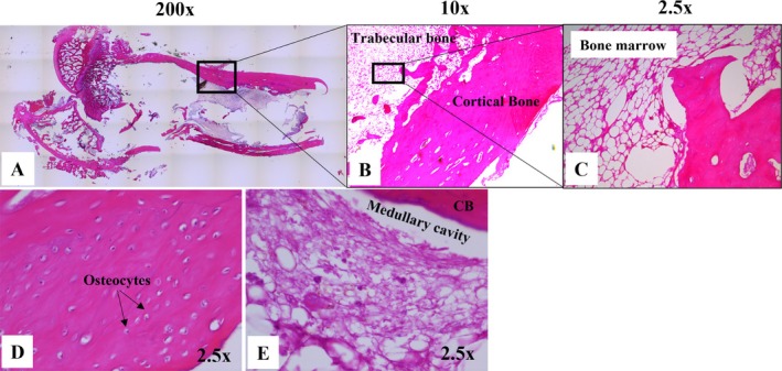 Establishment of Subtrochanteric Fracture in Pre-Clinical Animal Model.