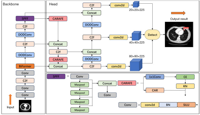 YOLOv8-BCD: a real-time deep learning framework for pulmonary nodule detection in computed tomography imaging.