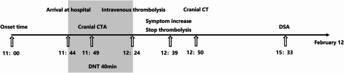 Safety and outcome of intravenous thrombolysis in ischemic stroke related to intracranial artery dissection.