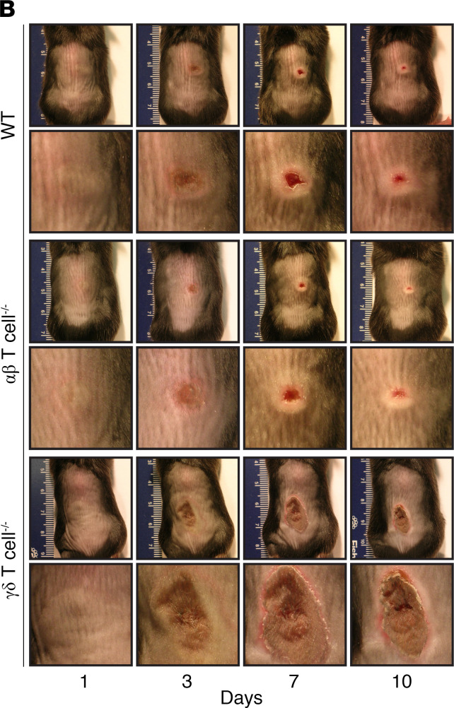 Corrigendum to IL-17 is essential for host defense against cutaneous Staphylococcus aureus infection in mice.