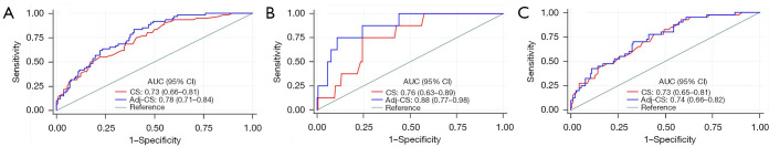 A scoring system combining CatLet score and clinical variables as a predictor of long-term prognosis in patients with chronic coronary syndrome after percutaneous coronary intervention.