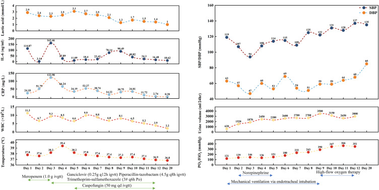 Diagnostic Challenges of Six-Pathogen Detected by mNGS in an Immunocompromised ICU Patient with Severe Community-Acquired Pneumonia-Induced Sepsis: A Case Report and Literature Review.