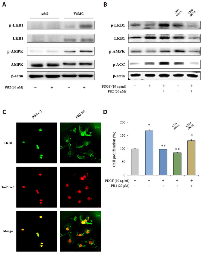 Procyanidin B2-induced LKB1-AMPK activation mitigates vascular smooth muscle cell proliferation through inhibition of mTOR signaling.