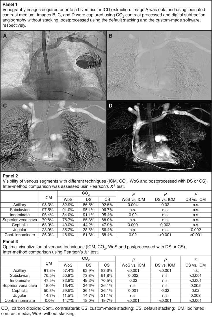 Prospective evaluation of carbon dioxide as a contrast medium in pacemakers or defibrillators carriers for venous angiography (SPARKLING pilot study).