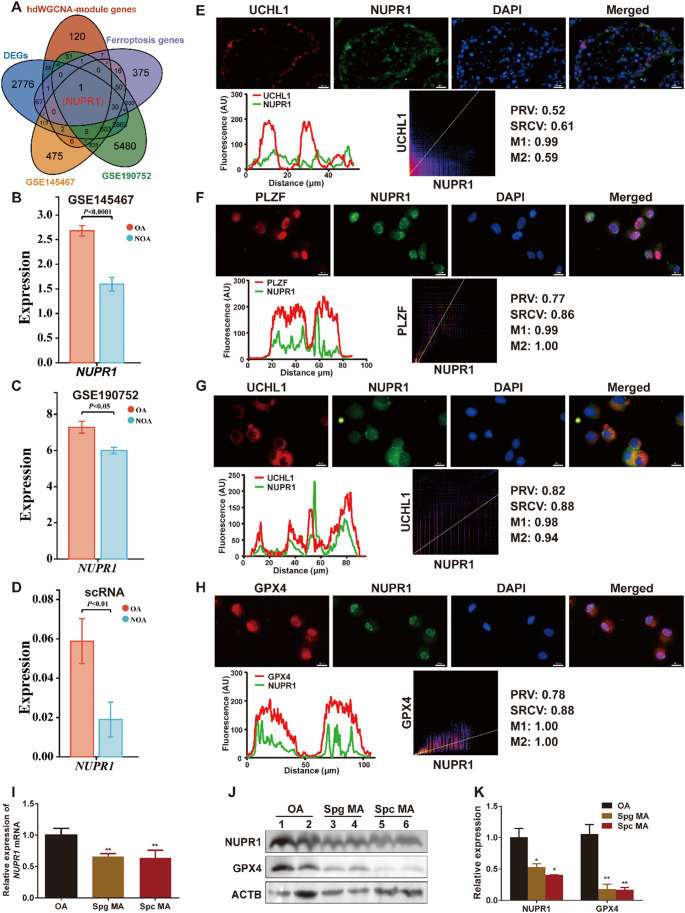 The transcriptional regulation of NUPR1 expression by MYC is implicated in the regulation of ferroptosis in human spermatogonial stem cells.