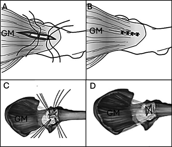 Soft-Tissue Sources of Extra-articular Pain Following Total Hip Arthroplasty: A Comprehensive Review.