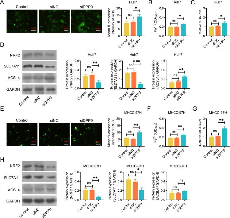 Inhibition of dipeptidyl peptidase 9 improves sorafenib sensitivity by inducing ferroptosis in hepatocellular carcinoma.