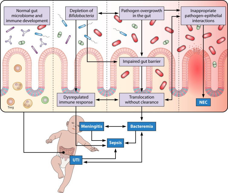 Consequences of host-microbiome interactions in preterm infants.
