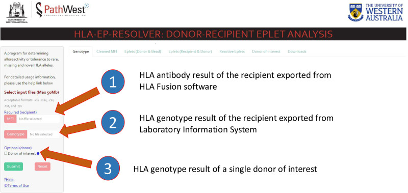 HLA-EP-RESOLVER: A Novel Web-based Bioinformatic Tool to Determine the Presence or Absence of DSA Against Rare HLA Alleles in the Era of Rapid High-resolution Deceased Donor HLA Genotyping.
