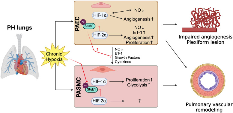Will Stub1 Be the Next Target for Pulmonary Hypertension Therapy Development?