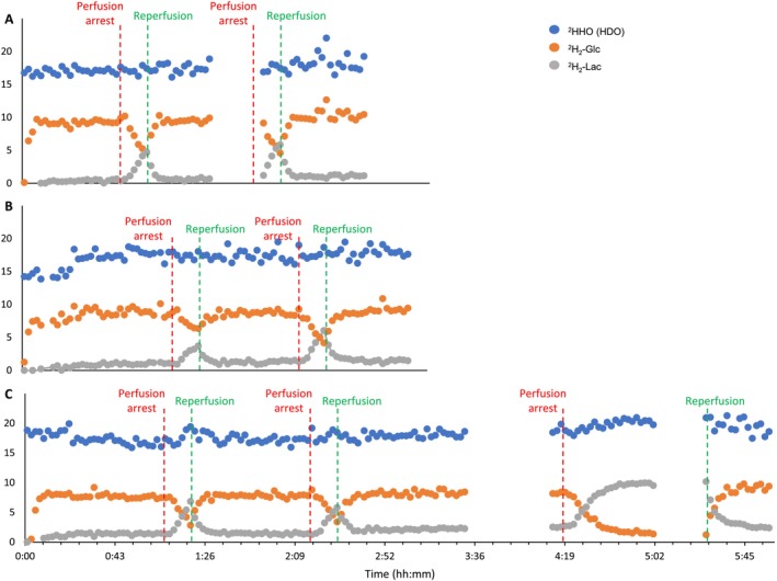 Feasibility of Deuterium Metabolic Magnetic Resonance Spectroscopy for the Investigation of Ischemia and Reperfusion in Rat Brain Slices Perfused Ex Vivo.
