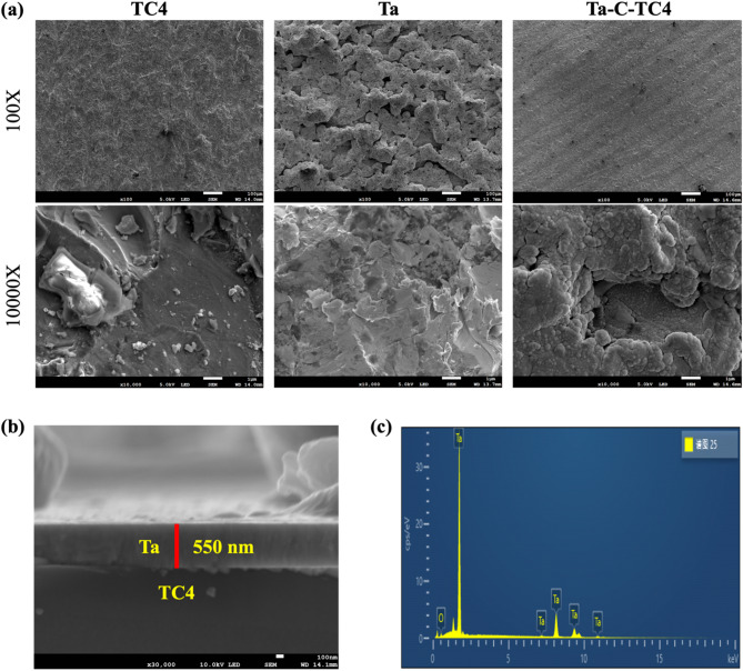 Magnetron sputtering to enhance bone integration of tantalum-coated titanium implants: an in vitro and in vivo analysis.
