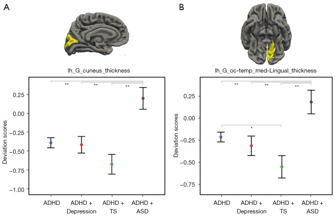 Insights into structural deviations in attention deficit hyperactivity disorder (ADHD) and comorbidities using big data-derived brain charts: a cross-sectional study.