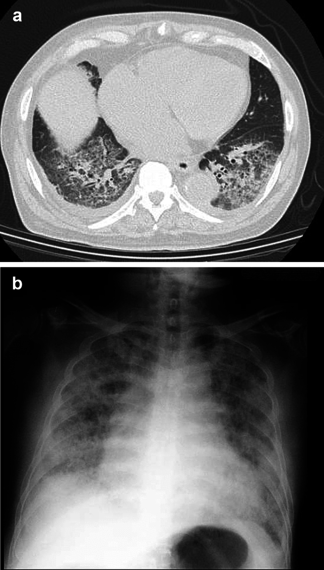 The potential of CT colonography for colorectal cancer screening in Japan.