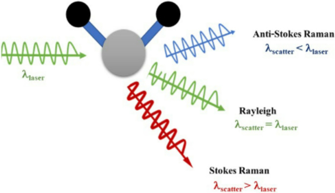Raman Spectroscopy and Machine Learning in the Diagnosis of Breast Cancer.
