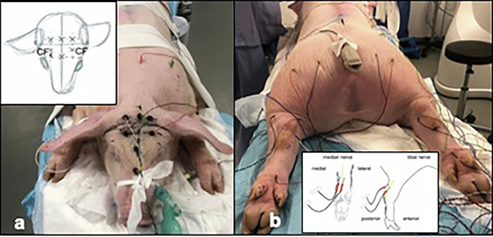 Electrochemotherapy of spinal metastasis using transpedicular approach: a preclinical safety animal study.